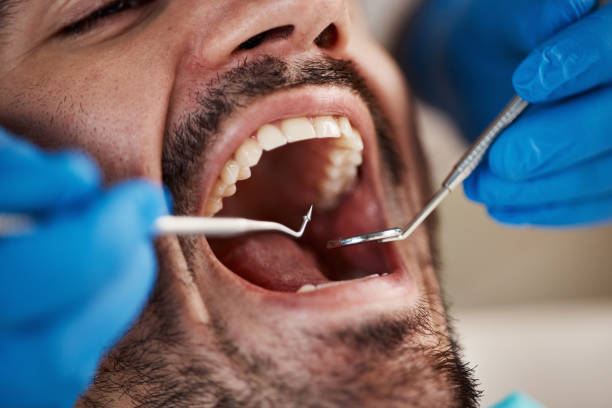 Best Emergency Dental Care for Broken or Chipped Teeth in Salt Lake City, UT